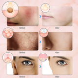 LumiSkin Therapy - Masque LED Réjuvenant 7 Couleurs