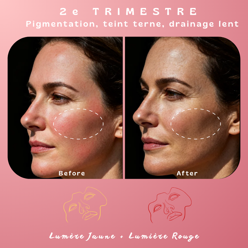 Masque de luminothérapie LED Akna – Souple & apaisant