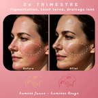 Masque de luminothérapie LED Akna – Souple & apaisant