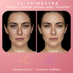 Masque de luminothérapie LED Akna – Souple & apaisant