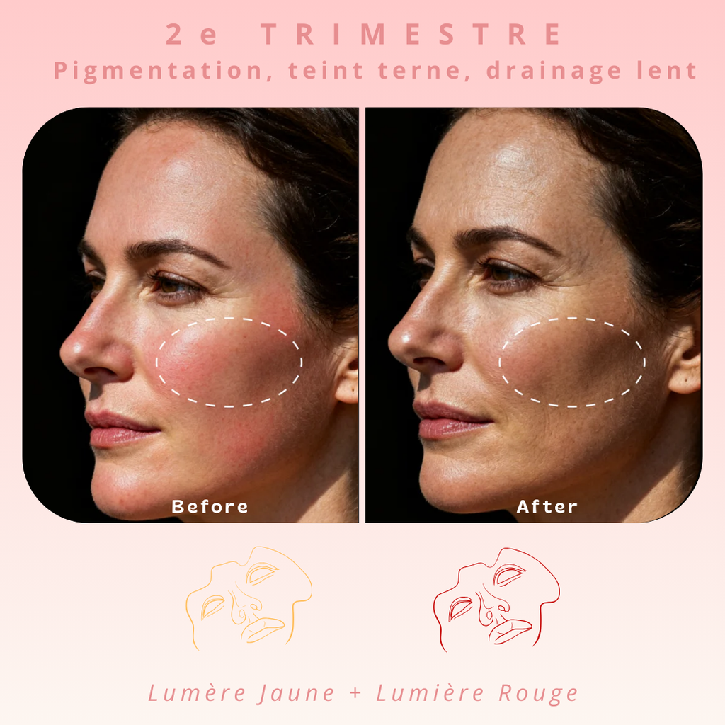 Masque de luminothérapie LED Akna – Souple