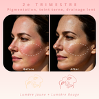 Masque de luminothérapie LED Akna – Souple