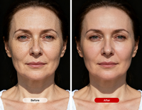 🌸 LumiSkin Therapy - Masque LED Réjuvenant 7 Couleurs